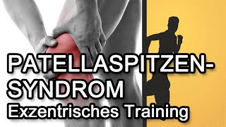 Patellaspitzensyndrom  Jumpers Knee  Ursachen amp Symptome Teil 1 [upl. by Ttreve]