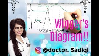 Ventricular Septal Defect VSD  Heart Auscultation  Episode 11 [upl. by Ainsley]