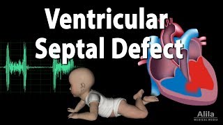 diastolic dysfunction part I  concept amp measurement [upl. by Varden280]