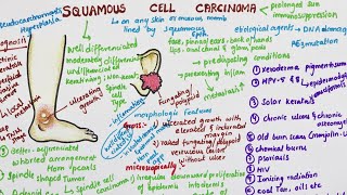 Squamous Cell Carcinoma  Pathology [upl. by Snapp343]