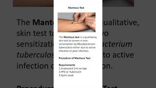 Mantoux test procedure [upl. by Eiclek]