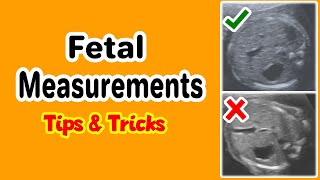 Fetal Measurements Tips and Tricks [upl. by Macswan]