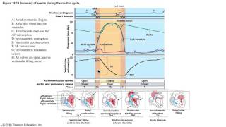 EKG l Supraventricular Tachycardia SVT [upl. by Arda300]