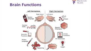 Mini Stroke TIA Strokehow are they different [upl. by Yrojram]