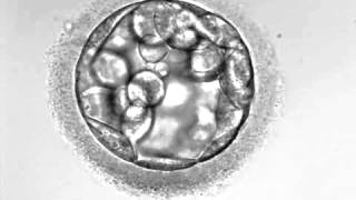 Development of hatching Embryo blastocyst stage [upl. by Zoltai104]