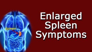 Enlarged Spleen Symptoms [upl. by Kirit]