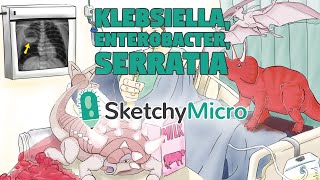 Klebsiella Enterobacter Serratia  SketchyMicro  Sketchy Medical USMLE Step 1 [upl. by Acirema647]