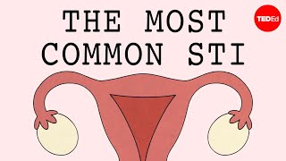 The most common STI in the world  Emma Bryce [upl. by Jemine]