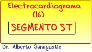 Electrocardiograma 16 Segmento ST [upl. by Ecital223]