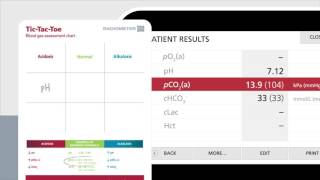 Reading the blood gas report using TicTacToe – Radiometer [upl. by Aneekahs]