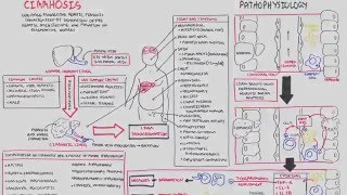 Liver Cirrhosis SandS Pathophysiology Investigations Management [upl. by Otrebmal318]