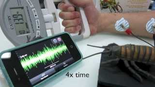 Dr Grant Performs EMG on The Doctors [upl. by Aliehs]