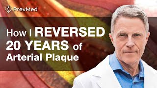 How I Reversed 20 years of Arterial Plaque [upl. by Ardnuhsal235]