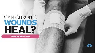 Can Chronic Wounds Heal  Patient Education Series [upl. by Puduns]