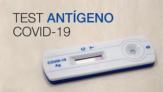 Test Antígeno COVID19 Clínica CEMTRO [upl. by Hope]