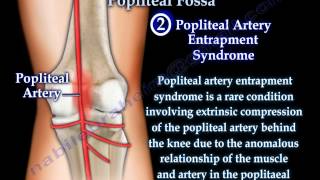 Anatomy Of The Popliteal Fossa  Everything You Need To Know  Dr Nabil Ebraheim [upl. by Erb671]