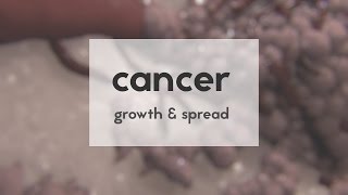 Cancer growth amp spread [upl. by Quillan700]