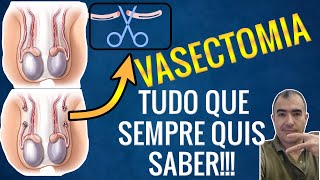 Vasectomia tudo aquilo que você precisa saber antes da cirurgia [upl. by Noynek45]