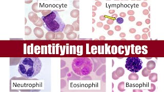 Identifying Leukocytes [upl. by Aicekal]