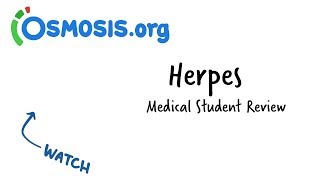 Herpes  Clinical Presentation [upl. by Ecar203]