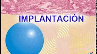 implantacion [upl. by Hanfurd]