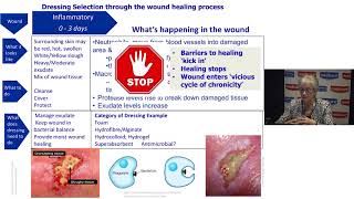 Understanding Wound Dressings Categories and Indications [upl. by Ennaear349]