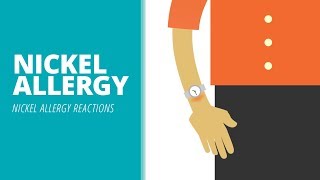 Nickel allergy – nickel allergic reactions [upl. by Alper]