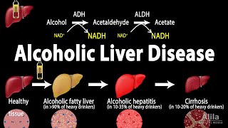 Alcoholic Liver Disease Animation [upl. by Hoag]