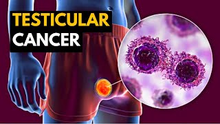 Testicular Cancer Causes Signs and Symptoms Diagnosis and Treatment [upl. by Kirch666]