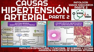 SINTOMAS DE HIPERTENSIÓN ARTERIAL FISIOPATOLOGÍA PARTE 2  GuiaMed [upl. by Yremrej]