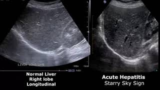 Hepatic lobule  Gastrointestinal system physiology  NCLEXRN  Khan Academy [upl. by Brawner]