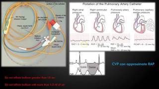 Hemodynamic Monitoring Part 1 [upl. by Fellner536]